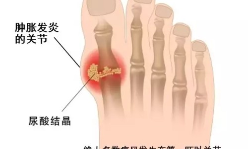 丸药用开水泡散了喝可以吗-丸药用开水冲开吃好吗网- 药丸直接吃和开水泡服有什么区别吗知识,分享丸药可以用水化开吃吗